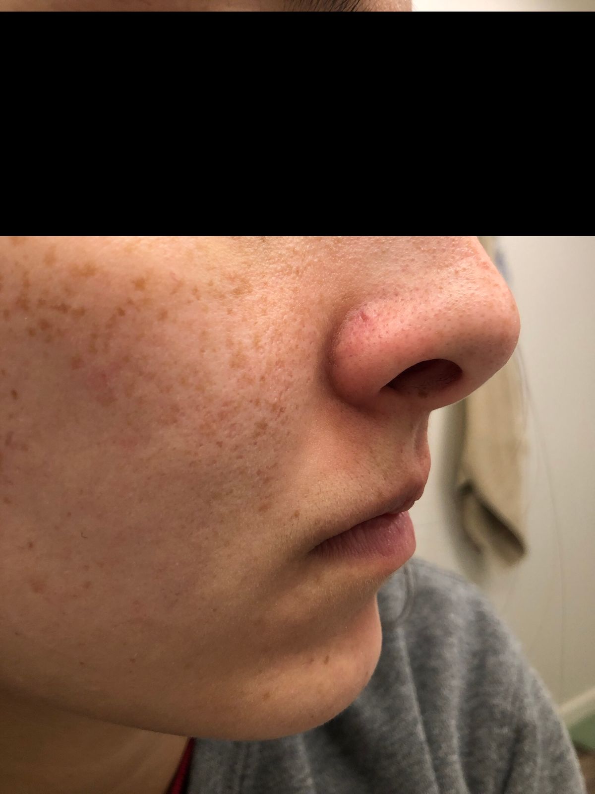 great barrier relief