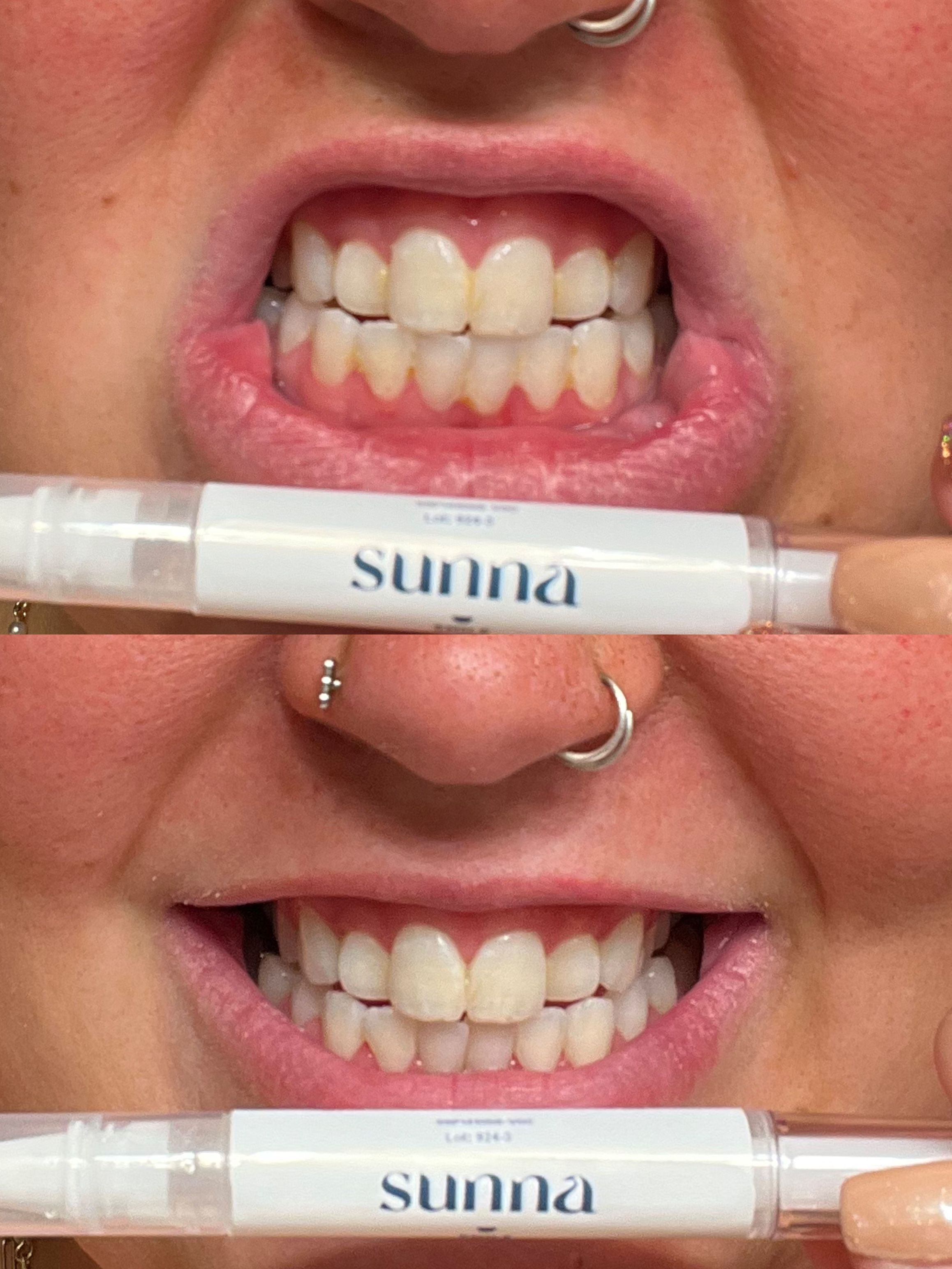 Vanilla Mint Kendall Jenner Teeth Whitening Pen Directions Moon