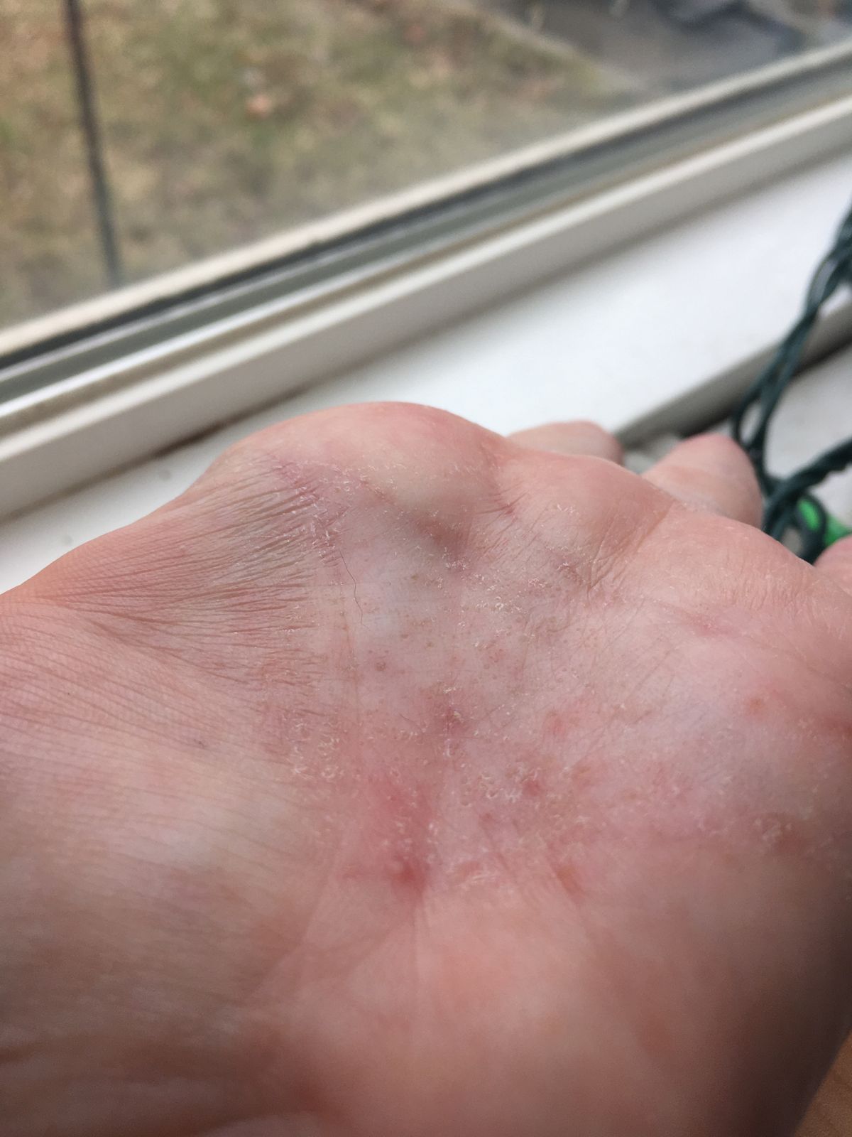 Eczema Honey Gentle Foaming Hand Soap Eczema Honey Co