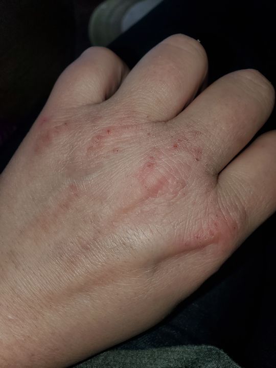 Eczema Honey Gentle Foaming Hand Soap Eczema Honey Co