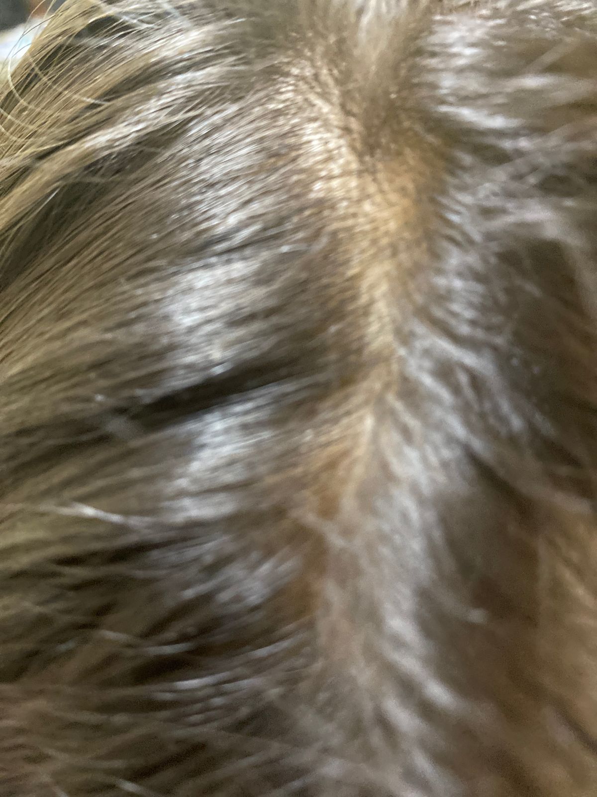 Eczema Honey Soothing Scalp Oil Eczema Honey Co