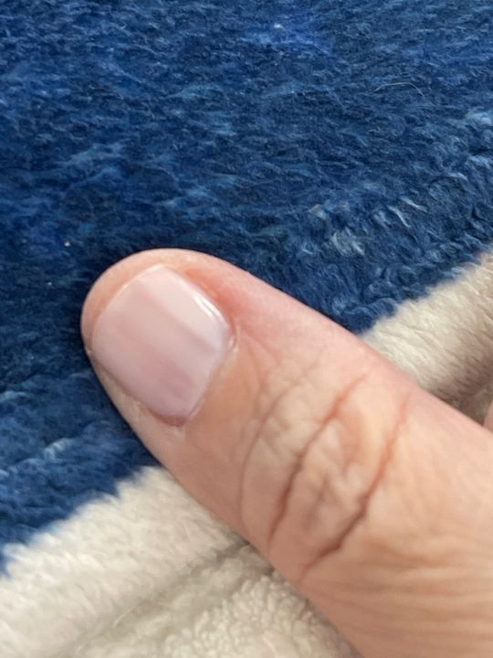 Fortifying Ridge Filler Nail Care LONDONTOWN Kur