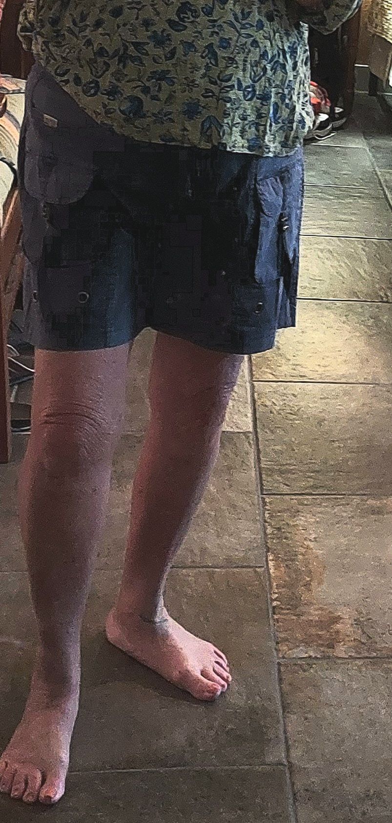Felix Short in Hypnotic Pigment